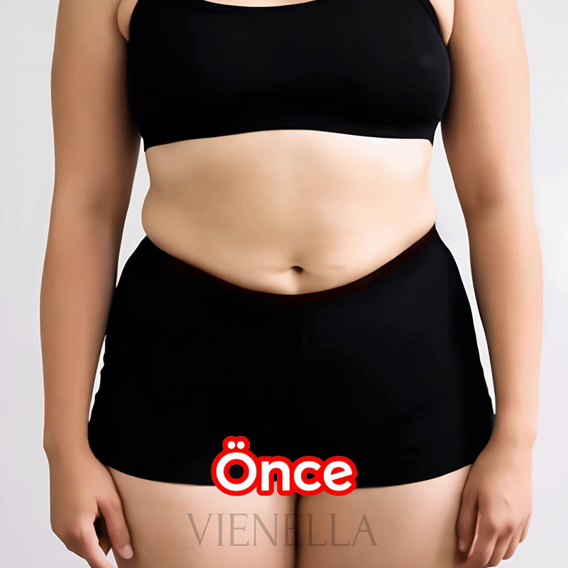 Vienella | Yağ Yakımını Destekleyen Korse